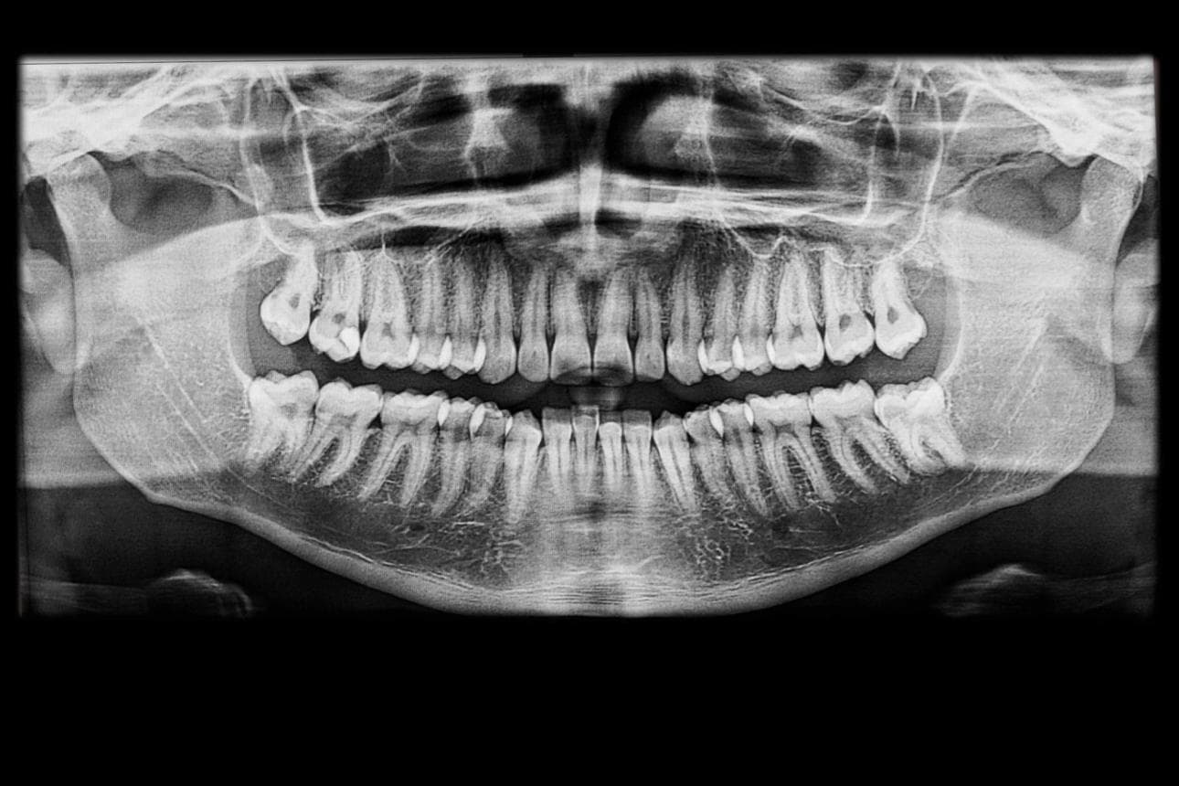 Oral Diagnoz ve Radyoloji